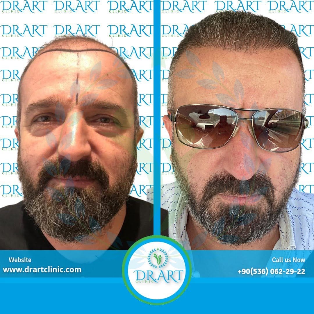 Post 10 by DR.ART CLINIC on Instagram (image)