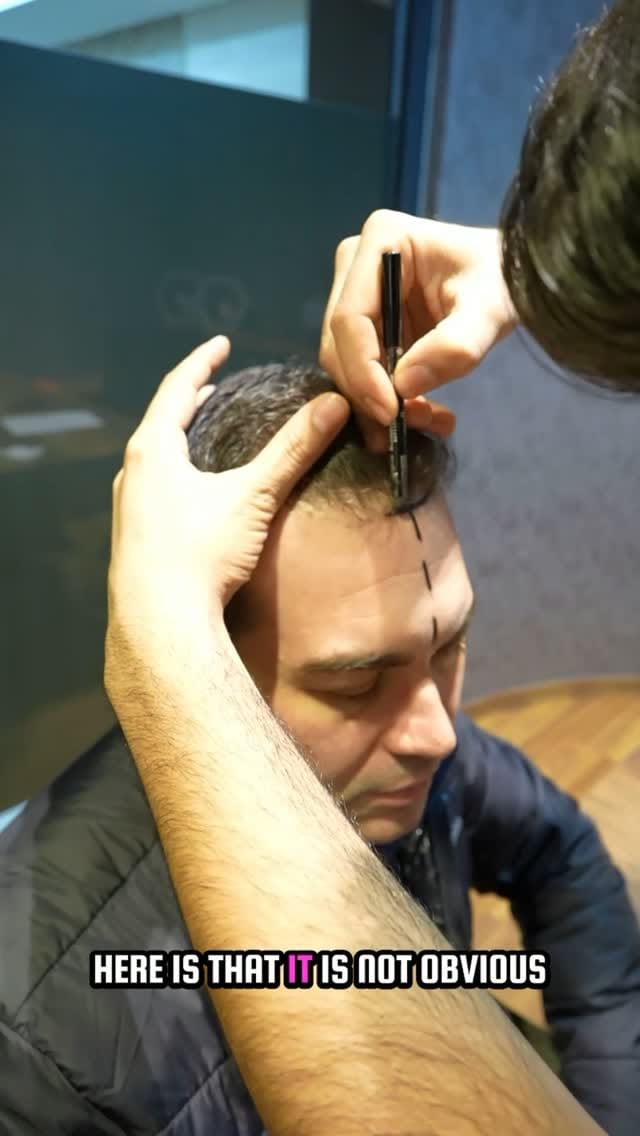Post 6 by DR.ART CLINIC on Instagram (video)