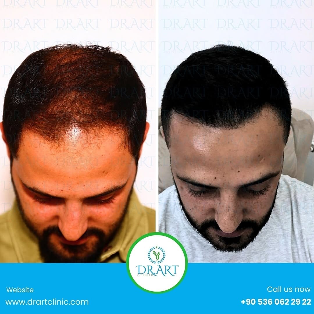 Post 8 by DR.ART CLINIC on Instagram (carousel)