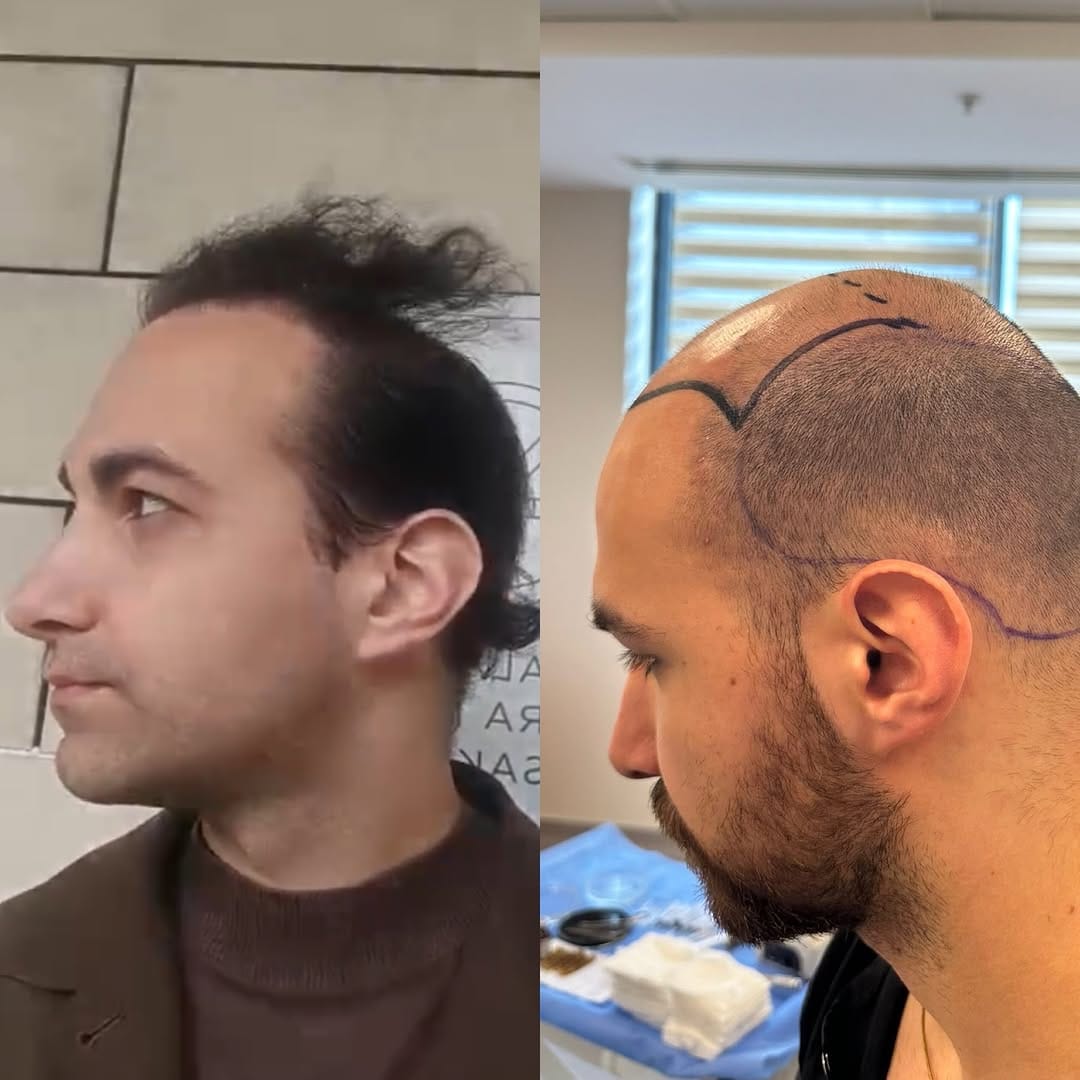 Post 2 by DR.ART CLINIC on Instagram (carousel)
