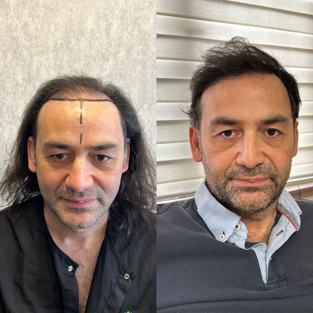 Post 1 by DR.ART CLINIC on Instagram (image)