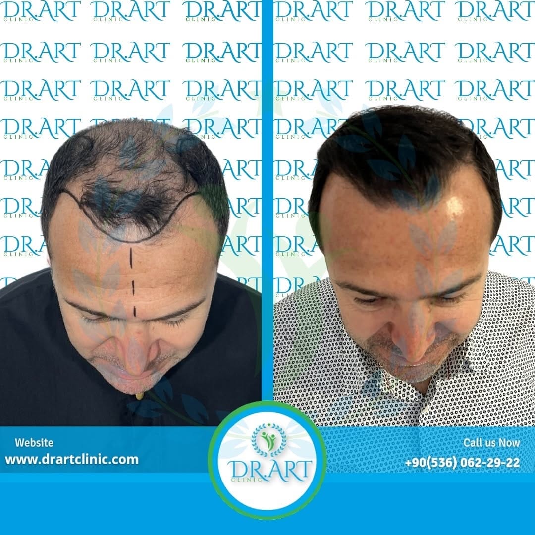 Post 9 by DR.ART CLINIC on Instagram (image)