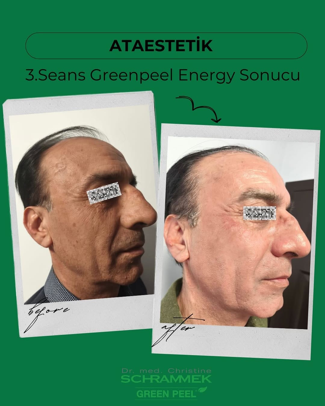 Post 1 by Evrim Cetinkaya on Instagram (image)