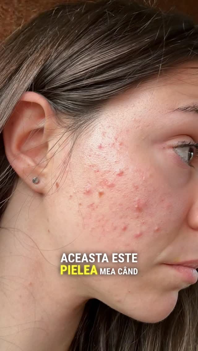 Post 6 by Inaessentials Romania on Instagram (video)