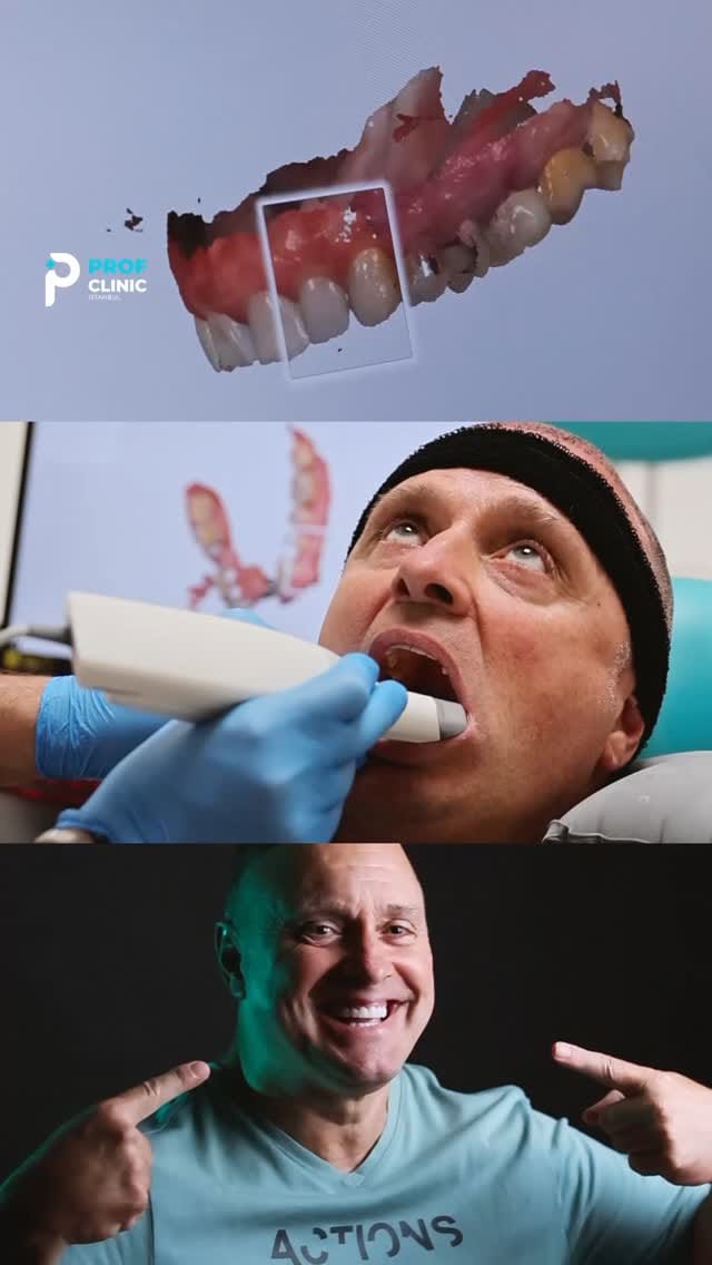 Post 2 by Prof Clinic on Instagram (video)