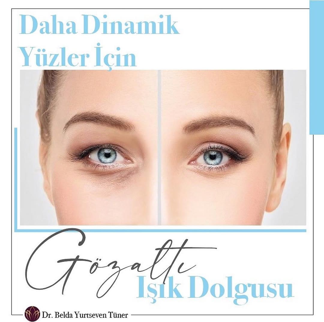 Post 10 by DR. BELDA YURTSEVEN TÜNER on Instagram (image)