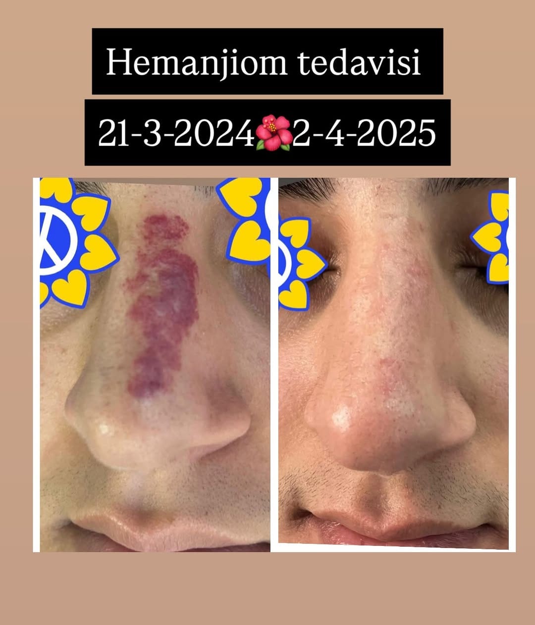 Post 1 by DR. BELDA YURTSEVEN TÜNER on Instagram (carousel)