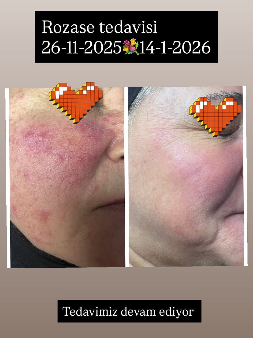 Post 6 by DR. BELDA YURTSEVEN TÜNER on Instagram (image)
