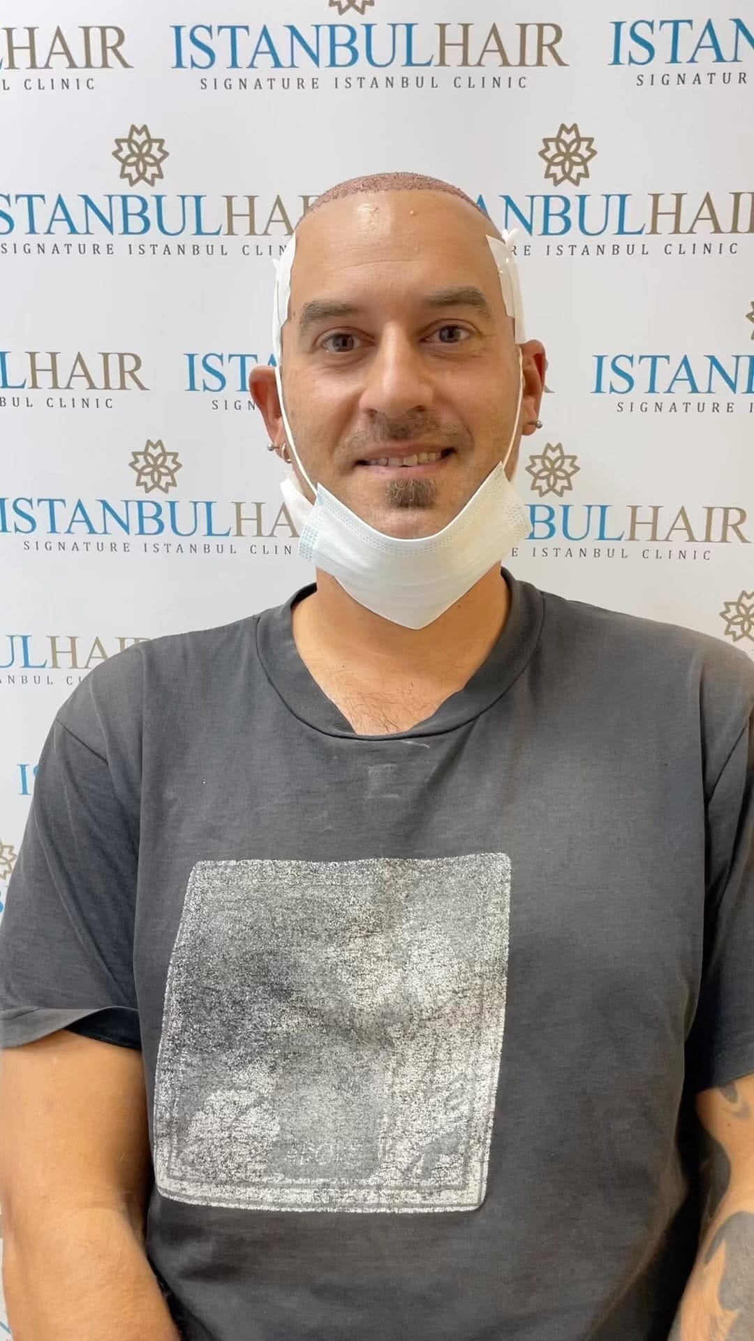 Post 5 by Istanbul Hair on Instagram (video)