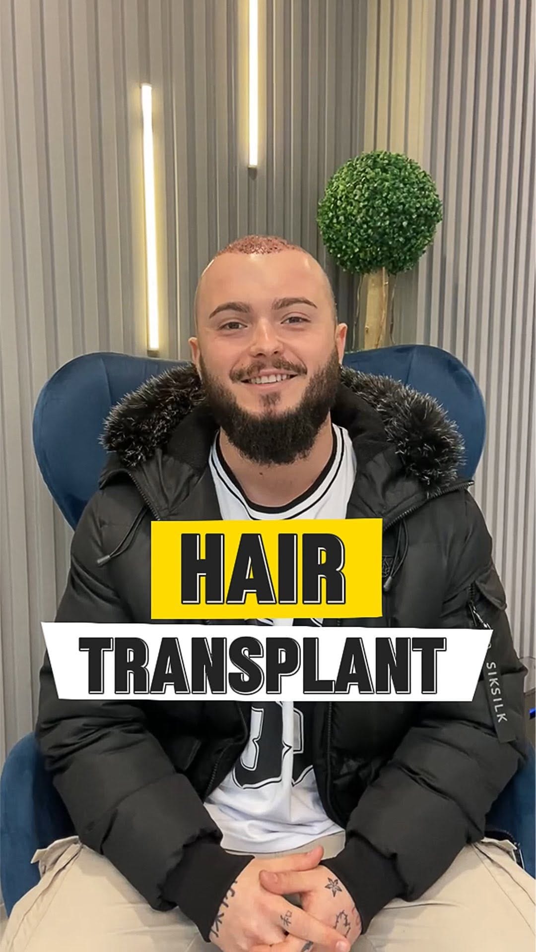 Post 10 by AESTHETİC CENTER on Instagram (video)