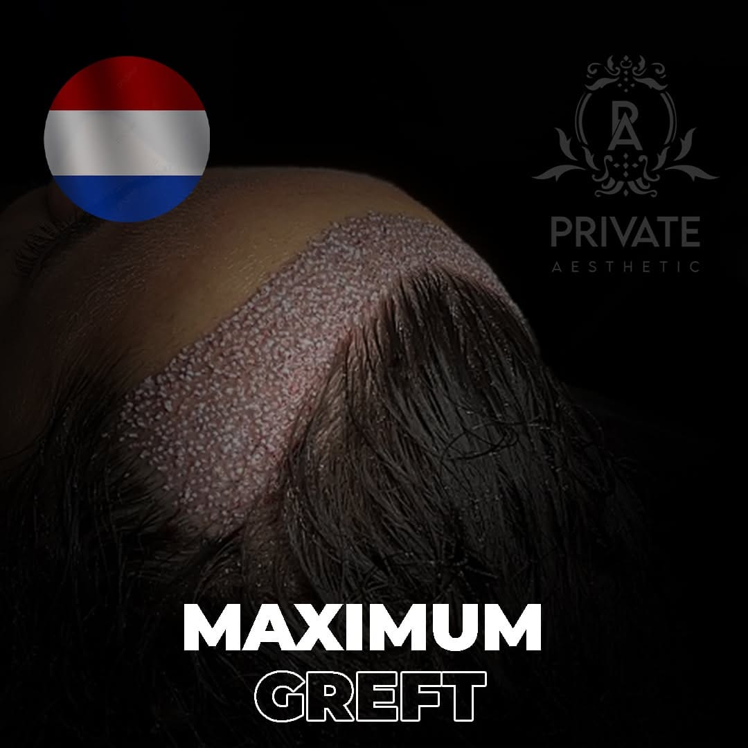 Post 3 by AESTHETİC CENTER on Instagram (image)
