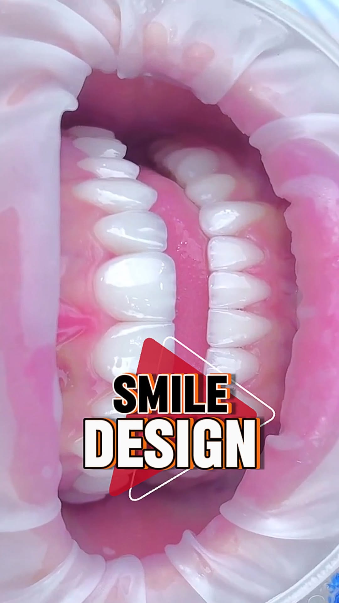 Post 9 by AESTHETİC CENTER on Instagram (video)