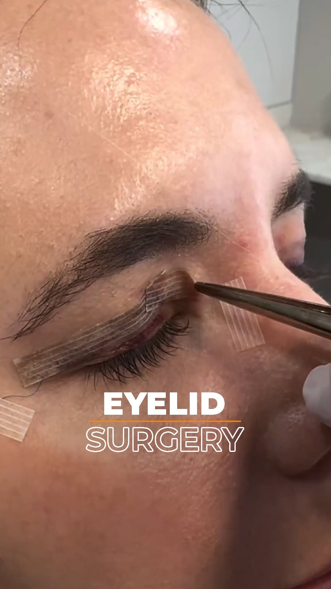 Post 8 by AESTHETİC CENTER on Instagram (video)
