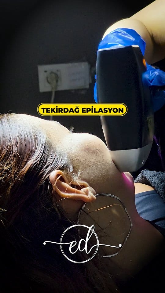 Post 2 by Eda Demir Beauty Center Tekirdağ 🏅 on Instagram (video)