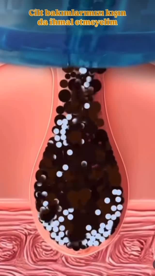 Post 7 by yzwellness on Instagram (video)
