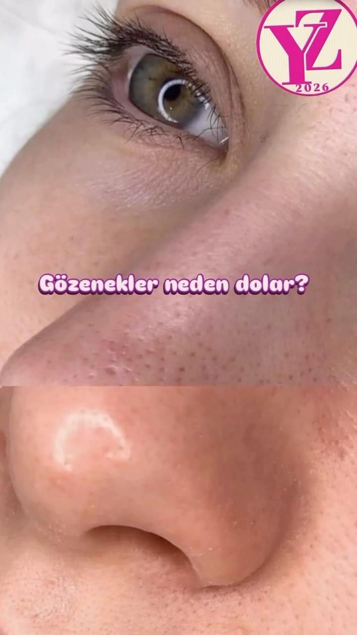 Post 4 by yzwellness on Instagram (video)