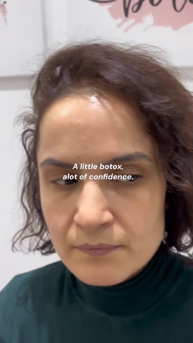 Post 4 by Evita Aesthetics on Instagram (video)