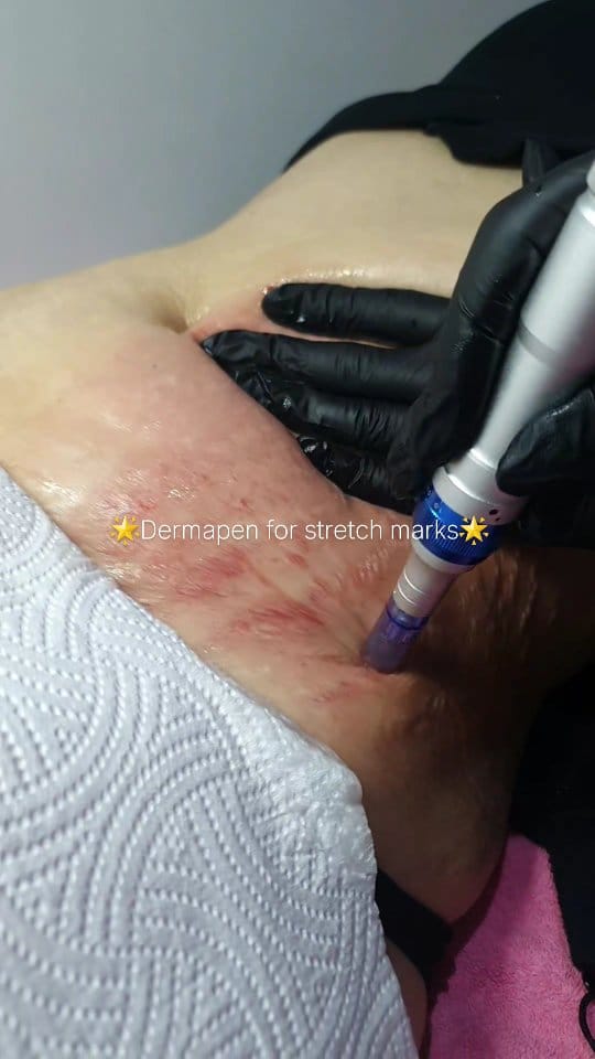 Post 3 by Evita Aesthetics on Instagram (video)