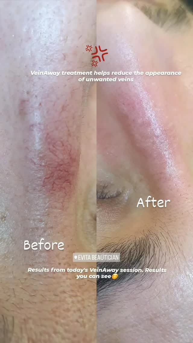 Post 8 by Evita Aesthetics on Instagram (video)