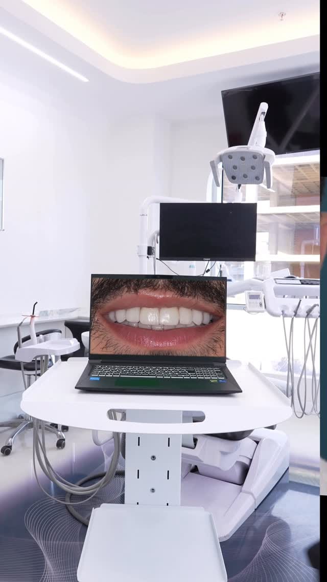 Post 2 by LongHairCenter|HairTransplant | Dental on Instagram (video)