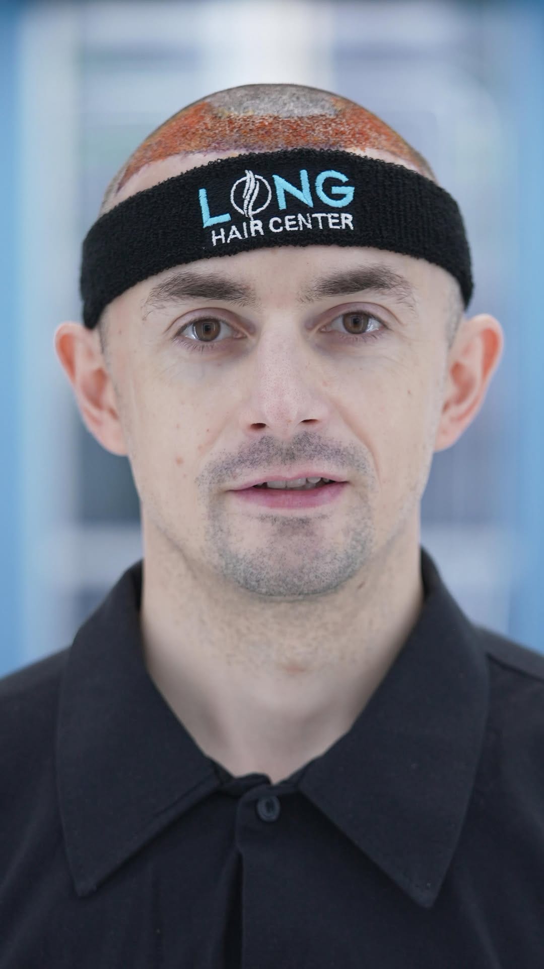 Post 5 by LongHairCenter|HairTransplant | Dental on Instagram (video)