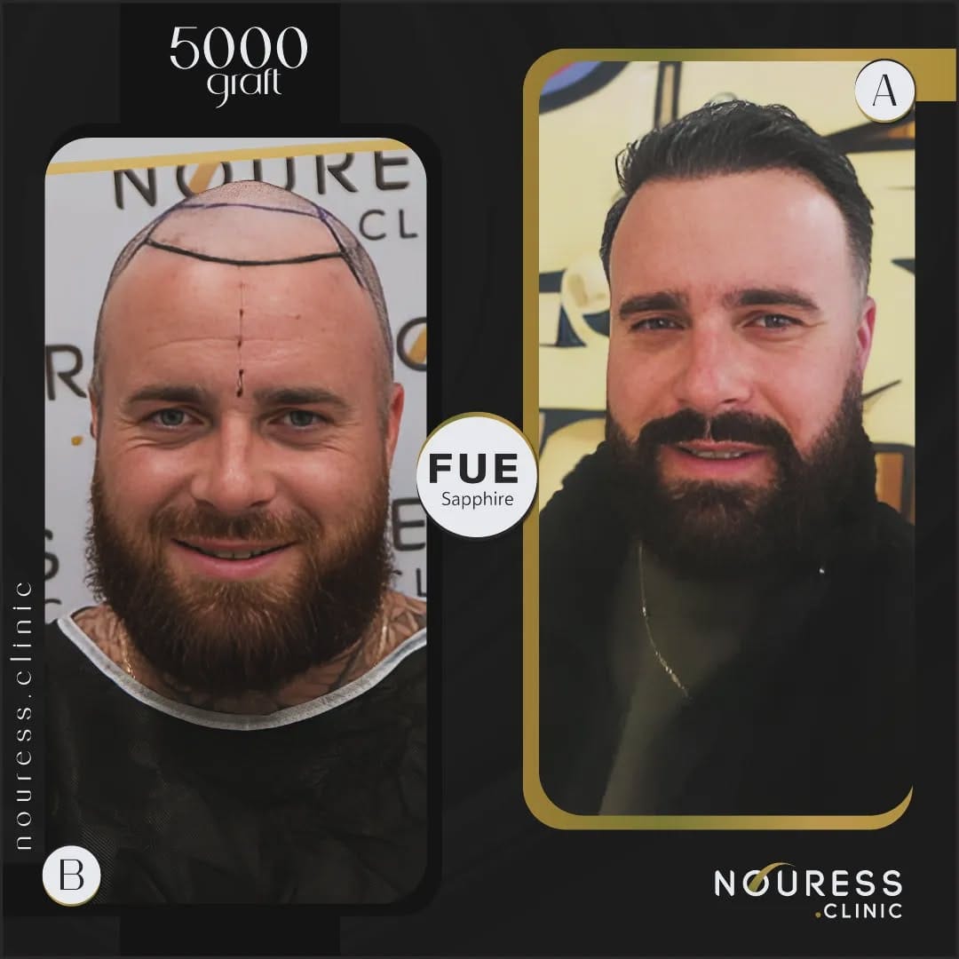 Post 10 by Nouress Clinic on Instagram (image)