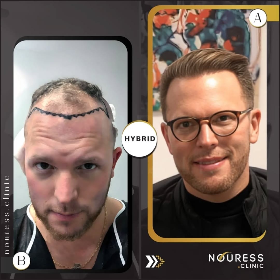 Post 5 by Nouress Clinic on Instagram (carousel)