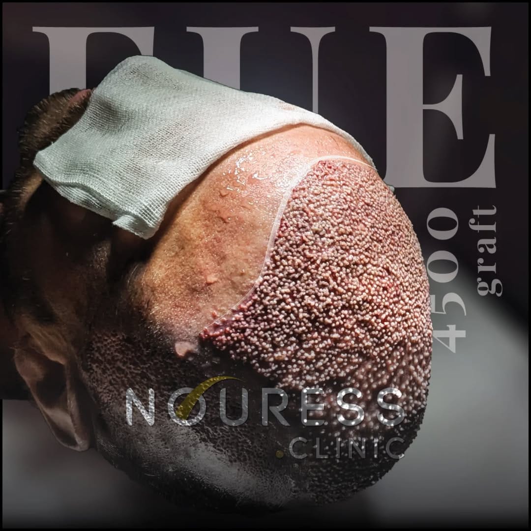 Post 7 by Nouress Clinic on Instagram (image)