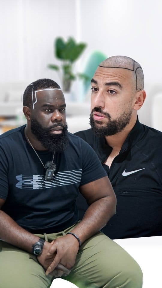 Post 1 by Panorama Hair Turkey on Instagram (video)