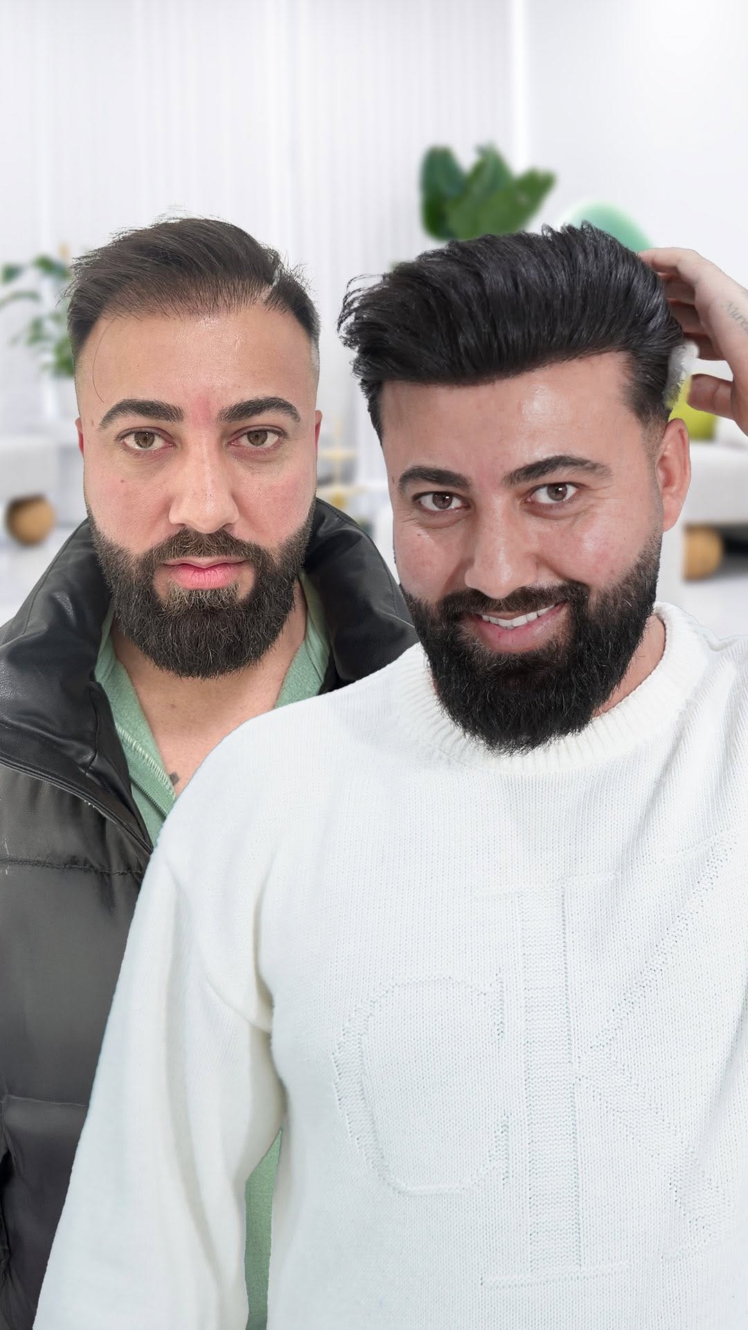 Post 4 by Panorama Hair Turkey on Instagram (video)