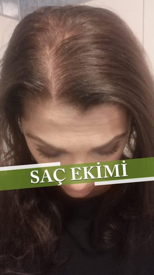 Post 6 by Este Power Clinic🇹🇷 on Instagram (video)