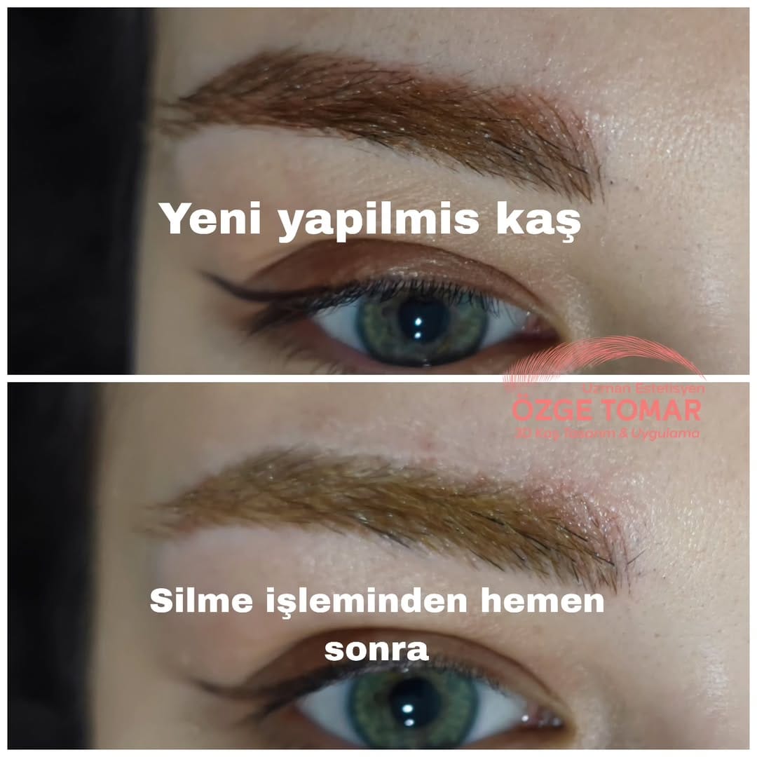 Post 1 by Özge Tomar on Instagram (image)