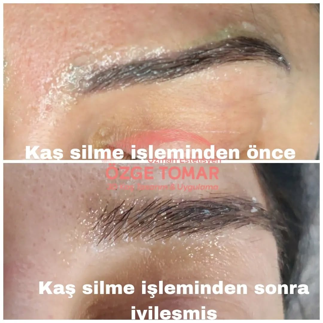 Post 5 by Özge Tomar on Instagram (image)