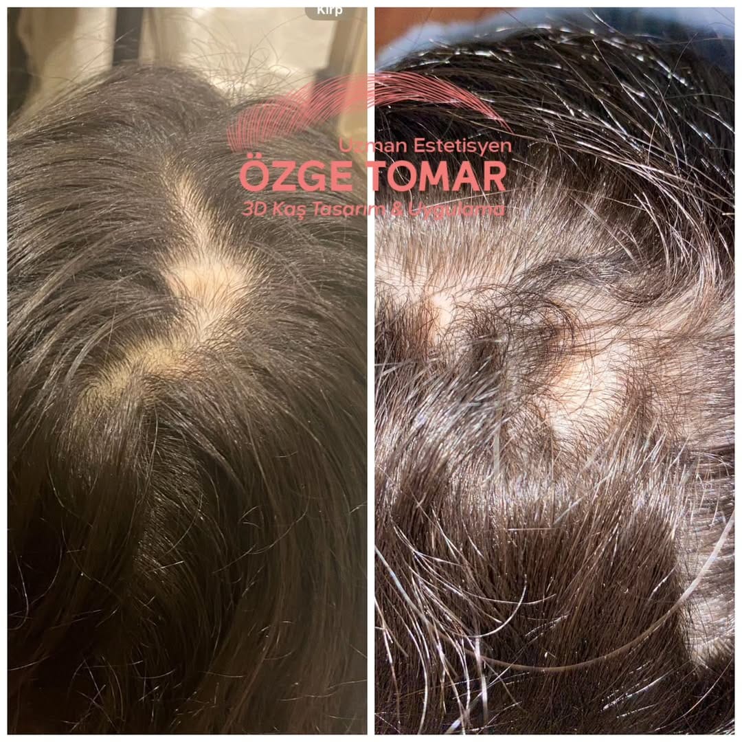 Post 2 by Özge Tomar on Instagram (image)