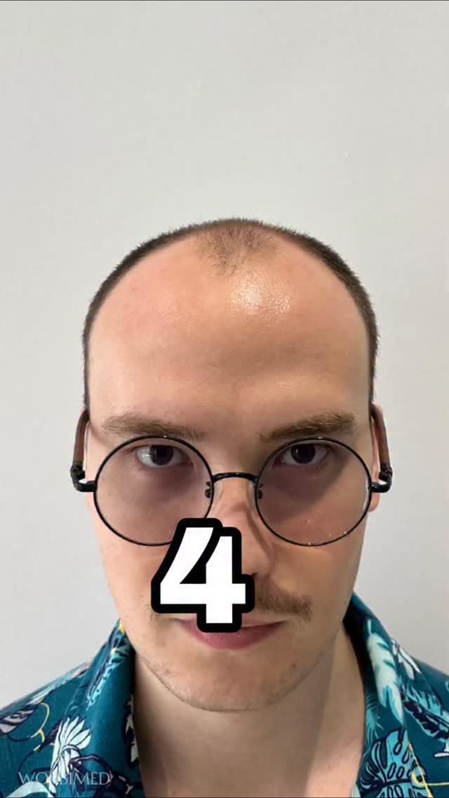 Post 2 by Hair Transplant in Turkey on Instagram (video)