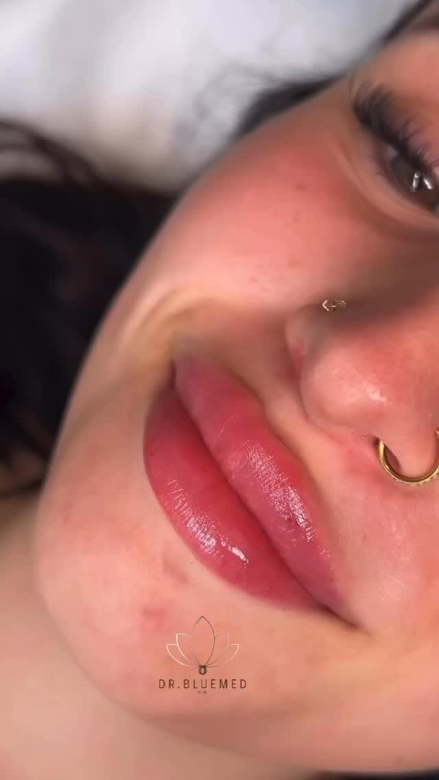 Post 5 by DR.bluemed clinica on Instagram (video)