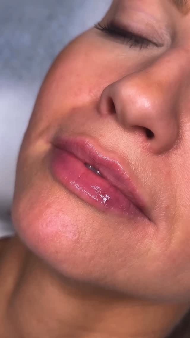 Post 6 by DR.bluemed clinica on Instagram (video)