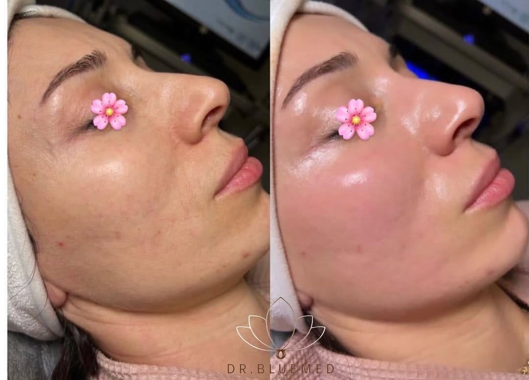 Post 8 by DR.bluemed clinica on Instagram (image)