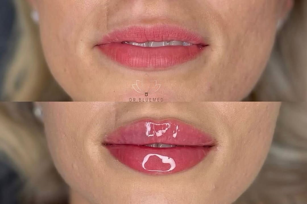Post 2 by DR.bluemed clinica on Instagram (image)