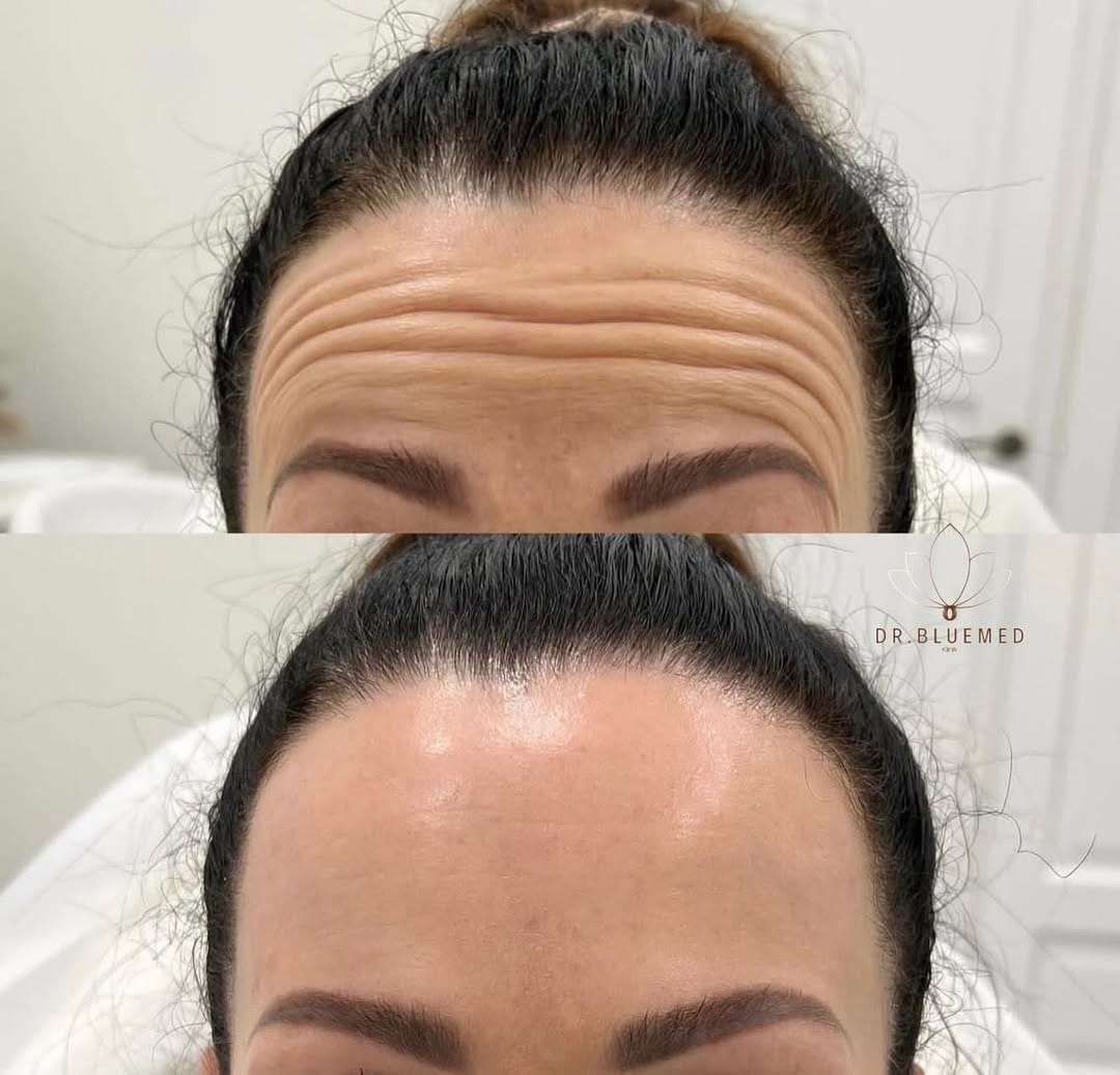 Post 9 by DR.bluemed clinica on Instagram (image)