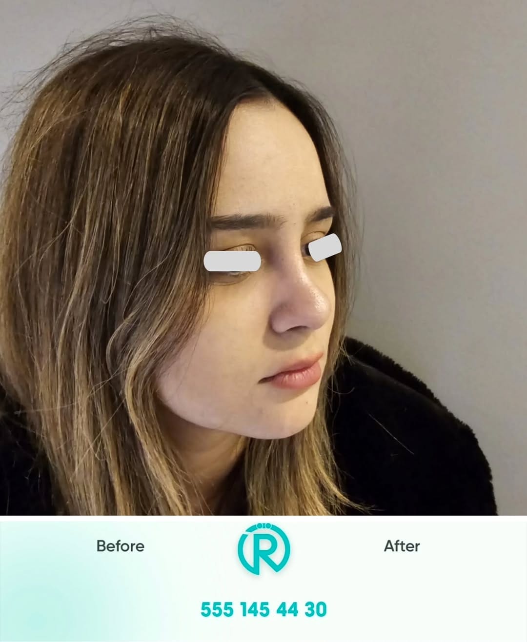 Post 8 by Op. Dr. Rahmi Özcelep on Instagram (carousel)