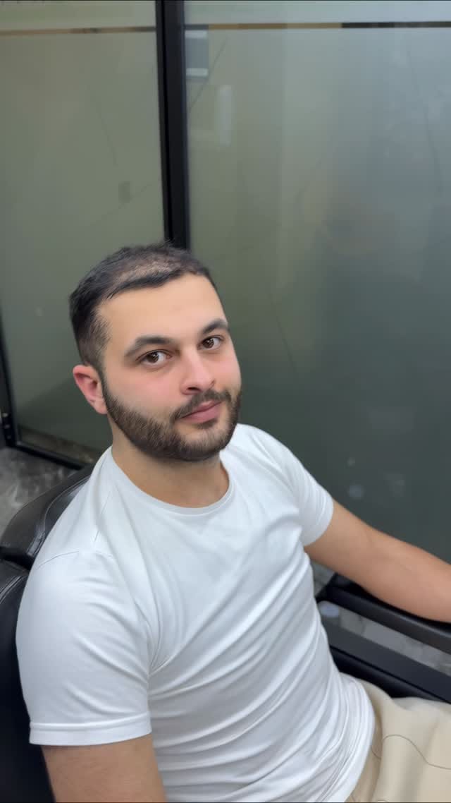 Post 6 by Protez Saç ve Saçlandırma Sistemleri on Instagram (video)