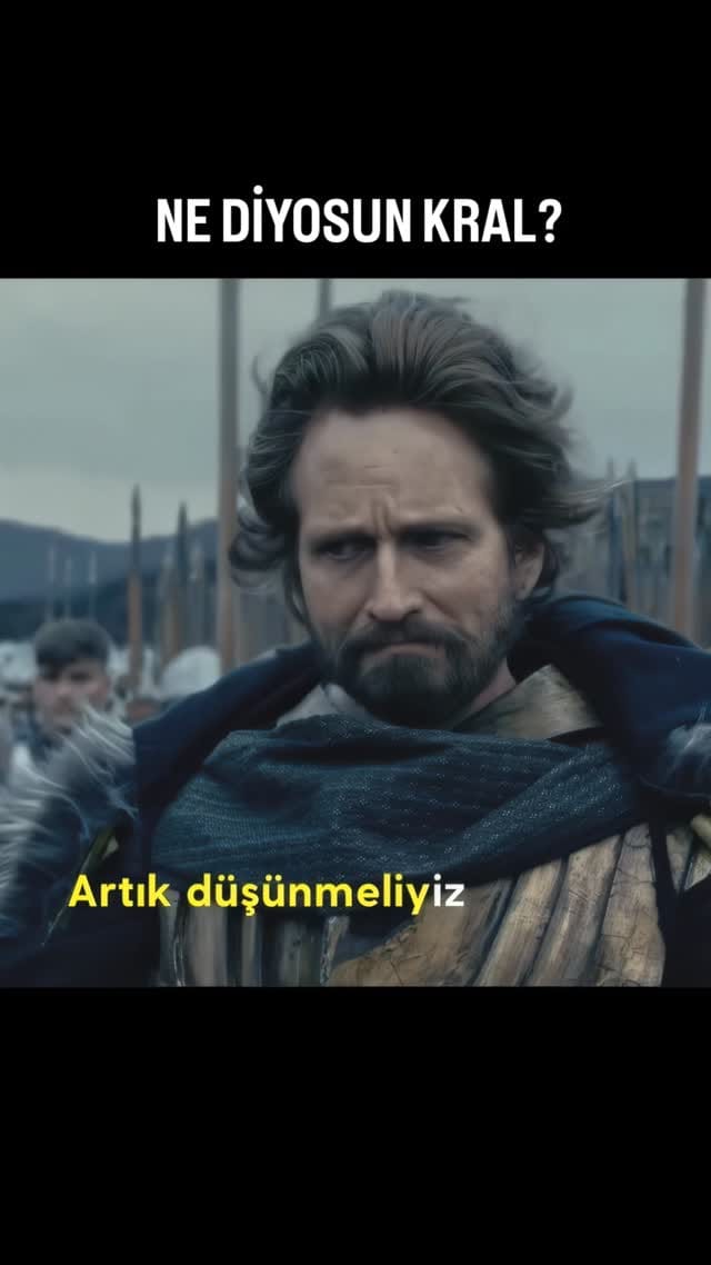 Post 7 by Protez Saç ve Saçlandırma Sistemleri on Instagram (video)