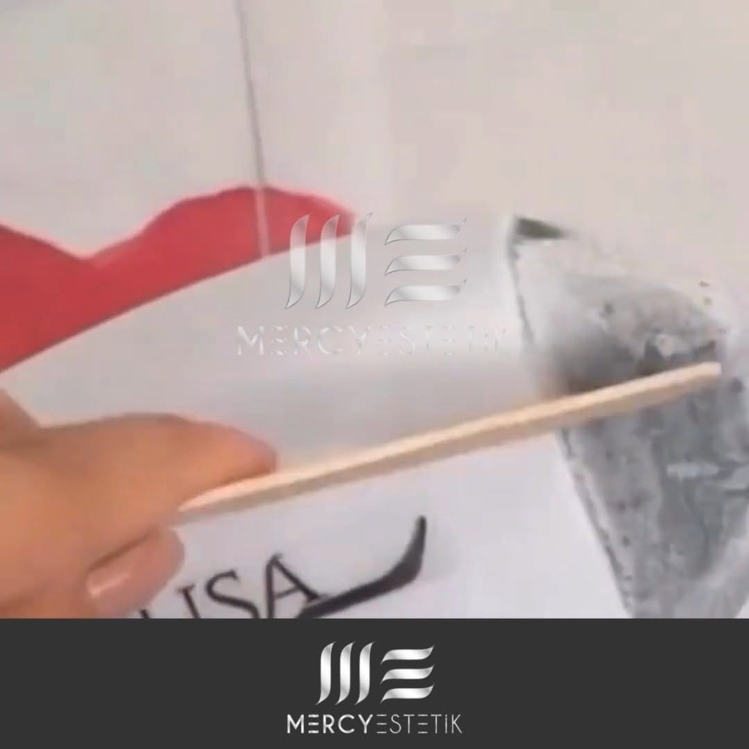Post 6 by Mercy Estetik on Instagram (video)