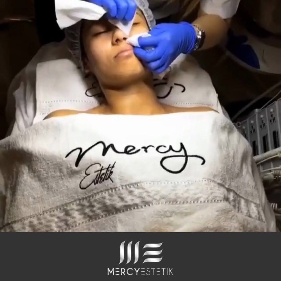Post 9 by Mercy Estetik on Instagram (video)