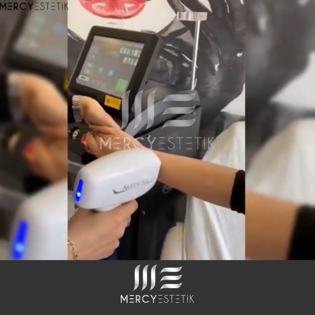 Post 5 by Mercy Estetik on Instagram (video)
