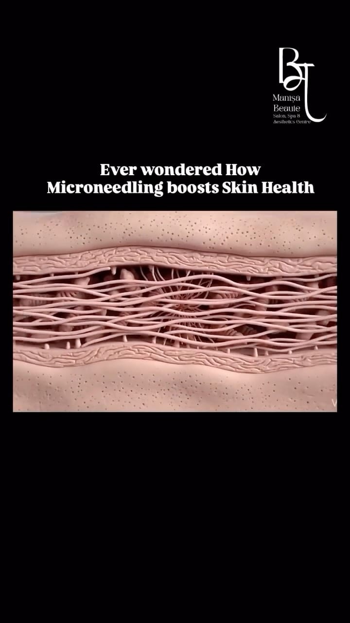 Post 5 by Dr Manisha Mittal | Manisa Beaute Co. on Instagram (video)