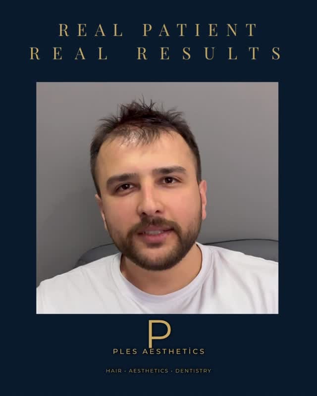 Post 2 by PLES AESTHETICS — Istanbul on Instagram (video)