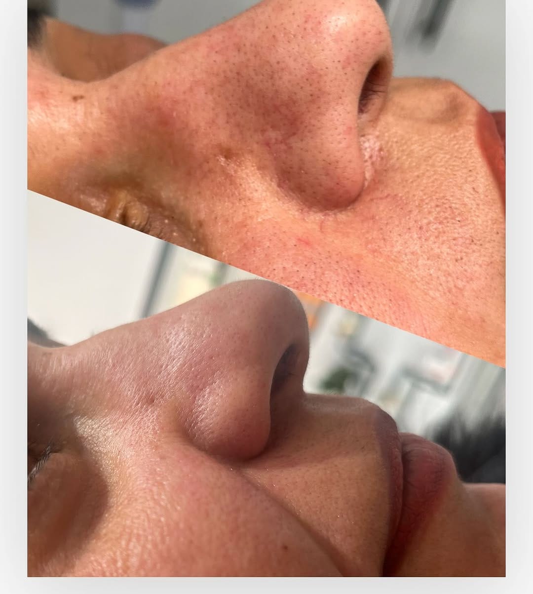Post 8 by Bahar Kaplan Beauty Center on Instagram (image)