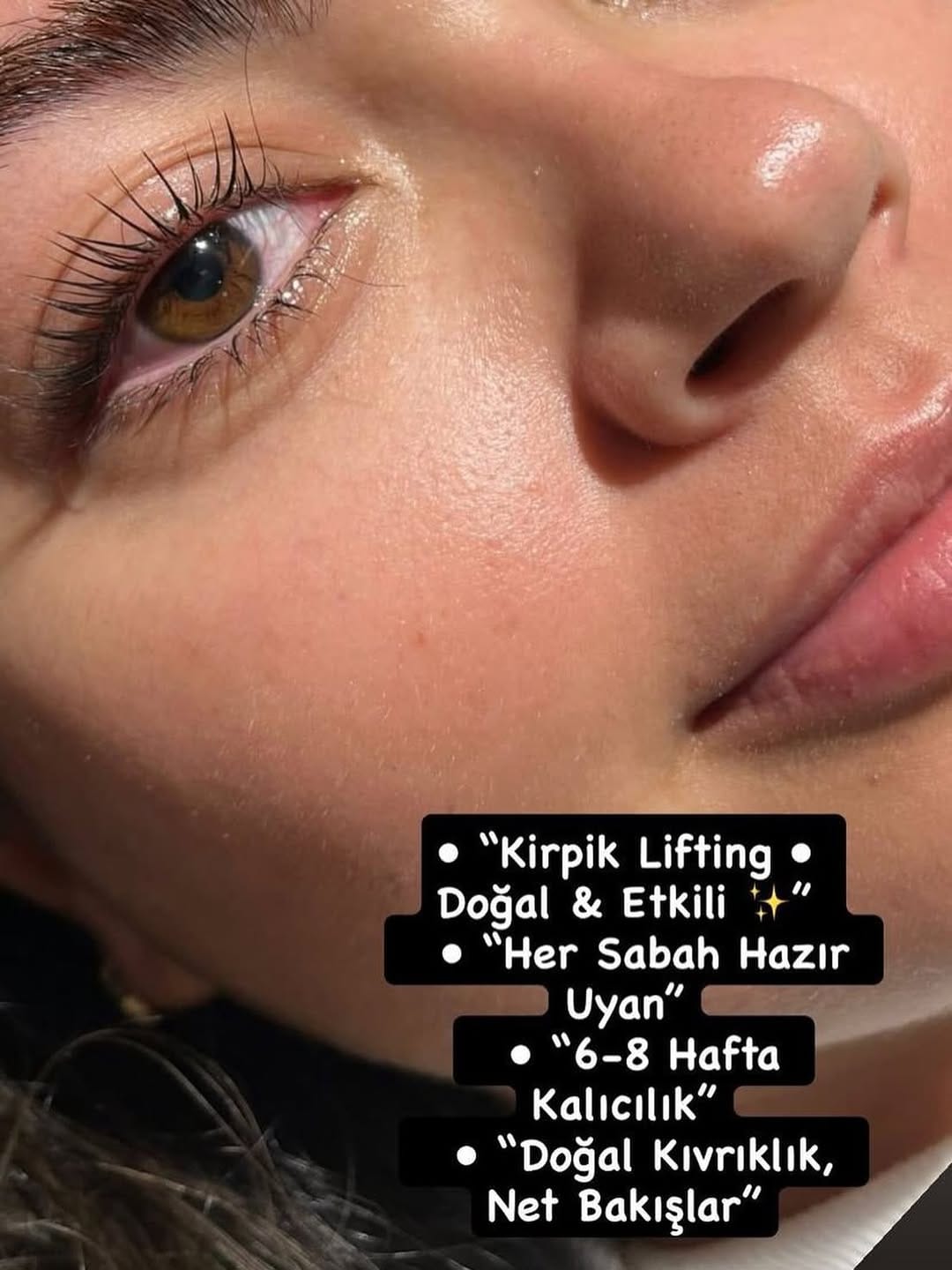 Post 3 by Bahar Kaplan Beauty Center on Instagram (image)